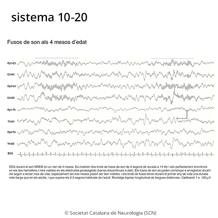 Imatge de resultat en el cercaterm