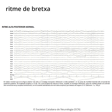 Imatge de resultat en el cercaterm