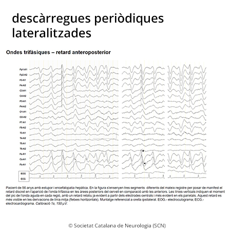 Imatge de resultat en el cercaterm